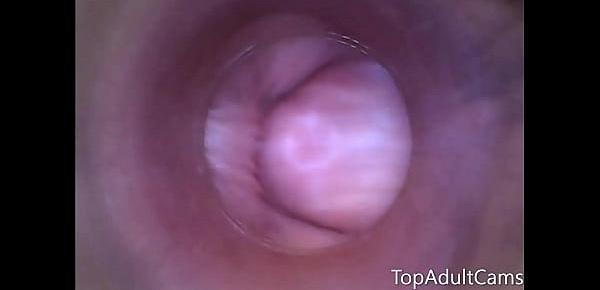  Endoscope Inside Pussy On Live Cam